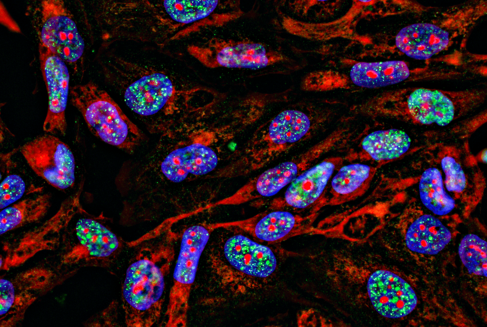 immunohistochemistry